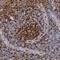 Spleen Associated Tyrosine Kinase antibody, NBP1-86178, Novus Biologicals, Immunohistochemistry paraffin image 