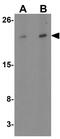 Transmembrane Protein 147 antibody, GTX31452, GeneTex, Western Blot image 