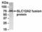 Solute Carrier Family 12 Member 2 antibody, NB100-75623, Novus Biologicals, Western Blot image 