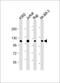 Cbl Proto-Oncogene antibody, M00152-1, Boster Biological Technology, Western Blot image 