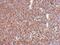Stress Induced Phosphoprotein 1 antibody, NBP2-20512, Novus Biologicals, Immunohistochemistry paraffin image 