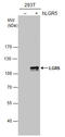 Leucine Rich Repeat Containing G Protein-Coupled Receptor 5 antibody, GTX129597, GeneTex, Western Blot image 