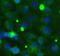 Translocation Associated Membrane Protein 1 antibody, FNab10225, FineTest, Immunofluorescence image 