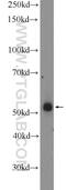 Zinc Finger Protein 256 antibody, 10360-1-AP, Proteintech Group, Western Blot image 