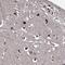 Anoctamin 10 antibody, PA5-62435, Invitrogen Antibodies, Immunohistochemistry paraffin image 