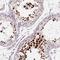 Heat Shock Transcription Factor 5 antibody, NBP2-49401, Novus Biologicals, Immunohistochemistry frozen image 