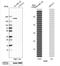 Zinc Finger E-Box Binding Homeobox 2 antibody, NBP1-82991, Novus Biologicals, Western Blot image 