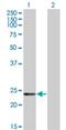 Recoverin antibody, H00005957-M05, Novus Biologicals, Western Blot image 