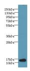 Basic Leucine Zipper ATF-Like Transcription Factor antibody, A58242-100, Epigentek, Western Blot image 