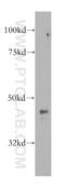 ADP Ribosylation Factor GTPase Activating Protein 1 antibody, 13571-1-AP, Proteintech Group, Western Blot image 