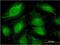 ATP Binding Cassette Subfamily F Member 1 antibody, MA5-18335, Invitrogen Antibodies, Immunofluorescence image 