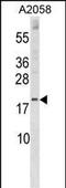 Sorting Nexin 3 antibody, A05169-2, Boster Biological Technology, Western Blot image 
