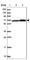 Zinc Finger And BTB Domain Containing 1 antibody, HPA050516, Atlas Antibodies, Western Blot image 