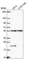 RNA Polymerase III Subunit D antibody, HPA061331, Atlas Antibodies, Western Blot image 