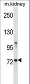 Tyrosine-protein kinase Tec antibody, LS-C164588, Lifespan Biosciences, Western Blot image 