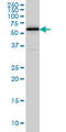 Histone Deacetylase 1 antibody, LS-B6096, Lifespan Biosciences, Western Blot image 