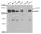 E3 ubiquitin-protein ligase UHRF1 antibody, PA5-37440, Invitrogen Antibodies, Western Blot image 
