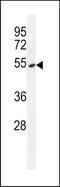 Tyrosyl-DNA Phosphodiesterase 2 antibody, TA324392, Origene, Western Blot image 