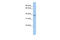 Mitochondrial Fission Factor antibody, 26-408, ProSci, Western Blot image 