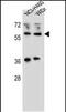 WT1 Interacting Protein antibody, PA5-48292, Invitrogen Antibodies, Western Blot image 