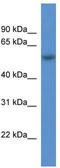 Polypyrimidine Tract Binding Protein 3 antibody, TA345914, Origene, Western Blot image 