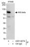 Inhibitor Of Nuclear Factor Kappa B Kinase Subunit Beta antibody, A301-827A, Bethyl Labs, Immunoprecipitation image 