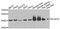 Acyl-CoA Dehydrogenase Short Chain antibody, STJ29310, St John