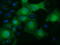 Ketohexokinase antibody, TA501283, Origene, Immunofluorescence image 