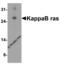 NFKB Inhibitor Interacting Ras Like 1 antibody, 2491, ProSci, Western Blot image 