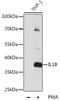 Interleukin 1 Beta antibody, LS-C746953, Lifespan Biosciences, Western Blot image 