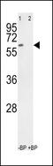 Receptor Like Tyrosine Kinase antibody, GTX25518, GeneTex, Western Blot image 