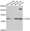 ATPase Plasma Membrane Ca2+ Transporting 2 antibody, A6875, ABclonal Technology, Western Blot image 