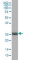 Phosphoethanolamine/phosphocholine phosphatase antibody, H00162466-M04, Novus Biologicals, Western Blot image 