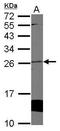 Cytoglobin antibody, GTX117571, GeneTex, Western Blot image 