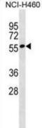 Zinc Finger Protein 302 antibody, abx030359, Abbexa, Western Blot image 