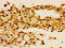 Histone Cluster 1 H1 Family Member B antibody, LS-C673222, Lifespan Biosciences, Immunohistochemistry paraffin image 