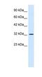 SWI/SNF Related, Matrix Associated, Actin Dependent Regulator Of Chromatin, Subfamily A, Member 2 antibody, NBP1-80042, Novus Biologicals, Western Blot image 