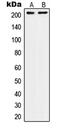 Integrin Subunit Beta 4 antibody, MBS820462, MyBioSource, Western Blot image 