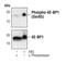 Eukaryotic Translation Initiation Factor 4E Binding Protein 1 antibody, MA5-14948, Invitrogen Antibodies, Western Blot image 
