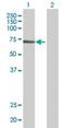 SAM And HD Domain Containing Deoxynucleoside Triphosphate Triphosphohydrolase 1 antibody, ab67820, Abcam, Western Blot image 