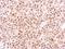 Proteasome 26S Subunit, ATPase 6 antibody, GTX114677, GeneTex, Immunohistochemistry paraffin image 