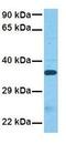 Vestigial Like Family Member 3 antibody, GTX45296, GeneTex, Western Blot image 