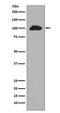 Signal Transducer And Activator Of Transcription 6 antibody, M00523, Boster Biological Technology, Western Blot image 