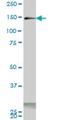 Phosphoinositide-3-Kinase Regulatory Subunit 4 antibody, H00030849-M05, Novus Biologicals, Western Blot image 