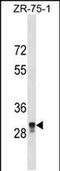 Metallophosphoesterase Domain Containing 2 antibody, PA5-49036, Invitrogen Antibodies, Western Blot image 