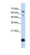 Thioredoxin 2 antibody, NBP1-54673, Novus Biologicals, Western Blot image 