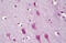 Potassium Voltage-Gated Channel Interacting Protein 3 antibody, MBS243880, MyBioSource, Immunohistochemistry frozen image 