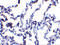 Ribonucleotide Reductase Regulatory TP53 Inducible Subunit M2B antibody, 56224, QED Bioscience, Immunohistochemistry frozen image 