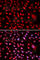 Core-Binding Factor Subunit Beta antibody, A5305, ABclonal Technology, Immunofluorescence image 