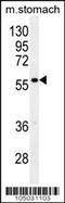 Glypican 3 antibody, 62-253, ProSci, Western Blot image 
